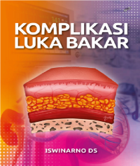 KOMPLIKASI LUKA BAKAR